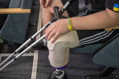 Amputations in Ukraine are as widespread as in the trenches of World War I due to Russia's heavy use of mines and artillery: report