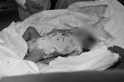 Office of Prime Minister Netanyahu Releases Horrifying and Disturbing Photos of Babies Murdered and Burned by Hamas Terrorists That Was Shown to Anthony Blinken