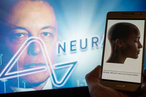 Elon Musk's Neuralink has thousands of people lined up for a brain chip implant. Here's what we know about the surgery that replaces a portion of your skull.
