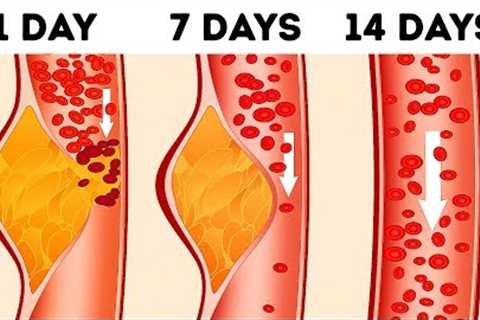 What's the DASH Diet and Why Doctors Call It the Best Diet
