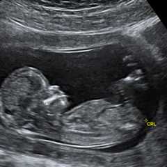 Abortion Providers Don’t Deserve Our Appreciation