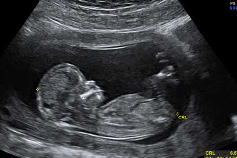 Abortion Providers Don’t Deserve Our Appreciation