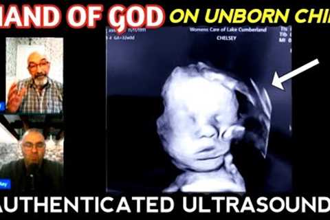 Mother prays repeatedly to God for her unborn child: Lord, please keep Your Hand on my baby!