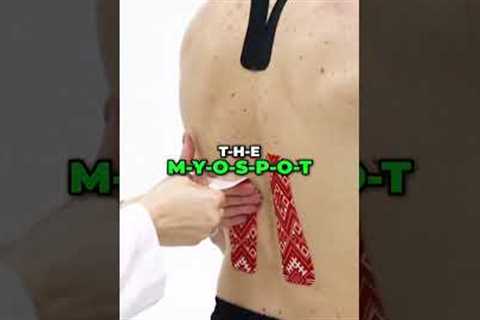 Unlock The Myo Spot: Your Secret to Ultimate Relaxation! #shorts