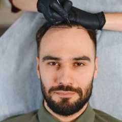 Top 10 Best Hair Transplant in Turkey